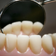 Teeth on a model denture set are reflected in a dental mirror on April 19, 2006 in Great Bookham, England.